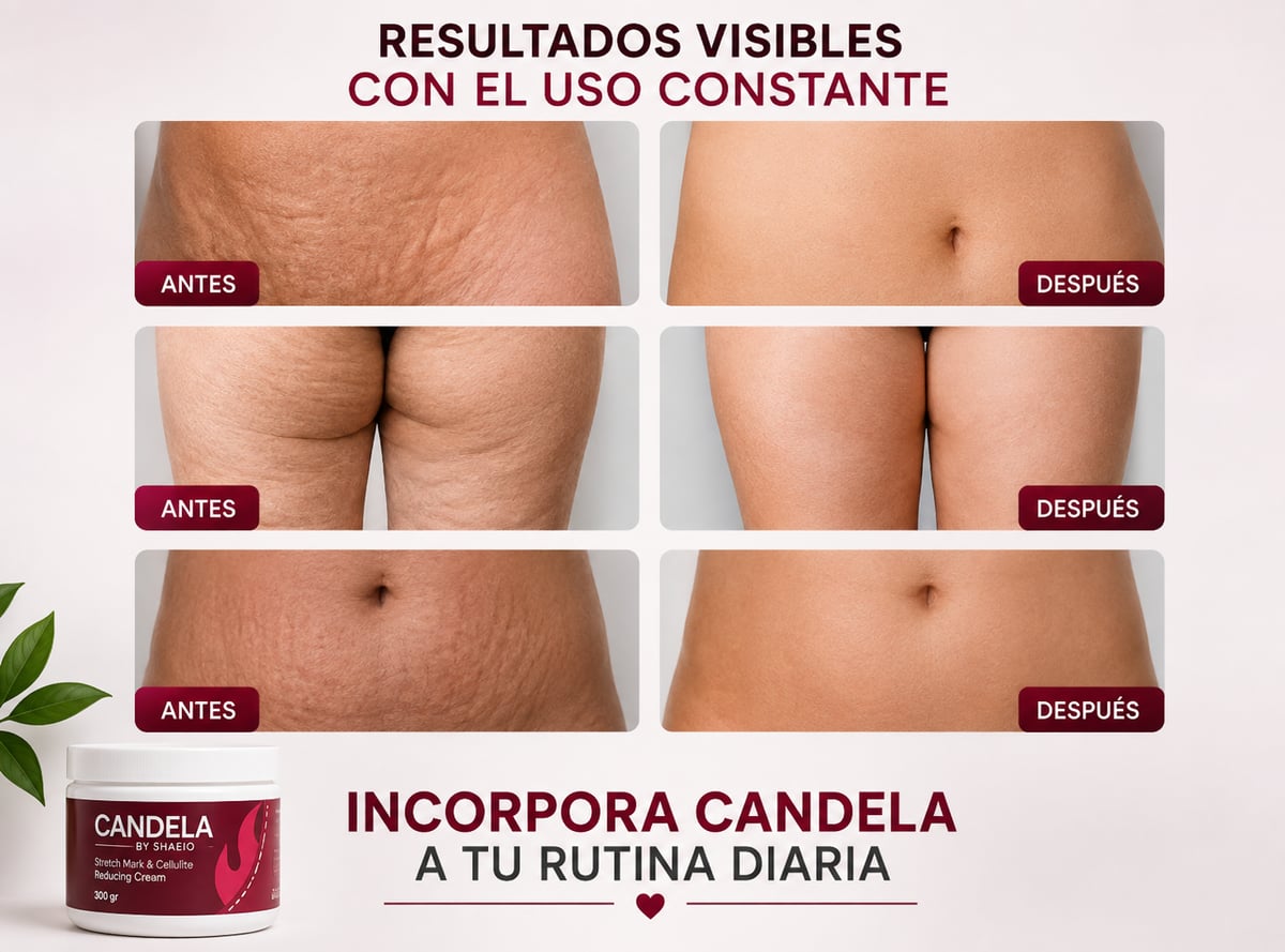 Candela by Shaeio - ¡Dile Adiós a las Estrías y Celulitis!