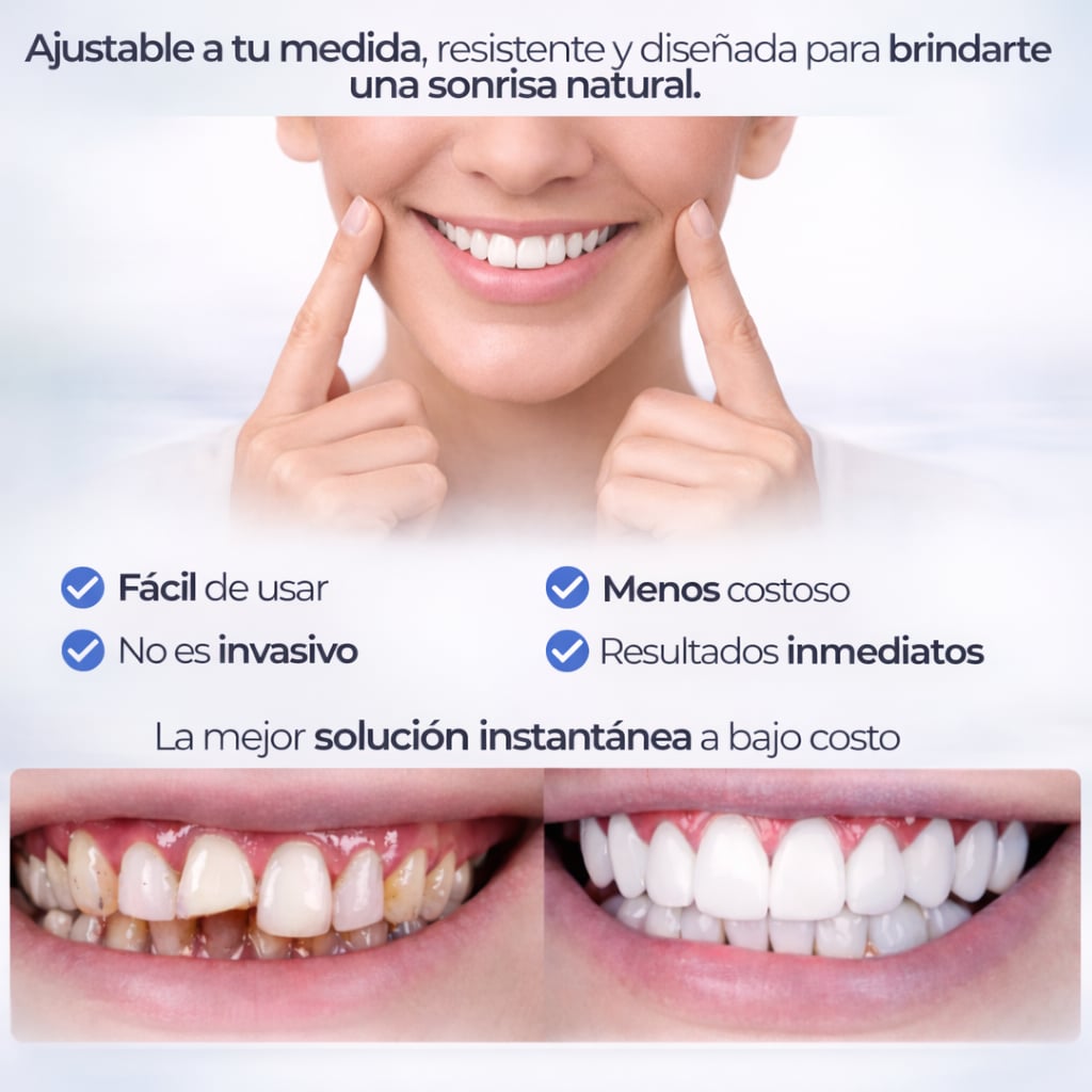 Snap Smile- Carillas dentales removibles