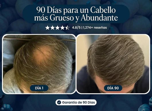 ULTIMAS UNIDADES-✨2x1 SHAMPOO EXCALVO REGENERADOR EFICAZ CONTRA LA CALVICIE+ENVIO GRATIS✨