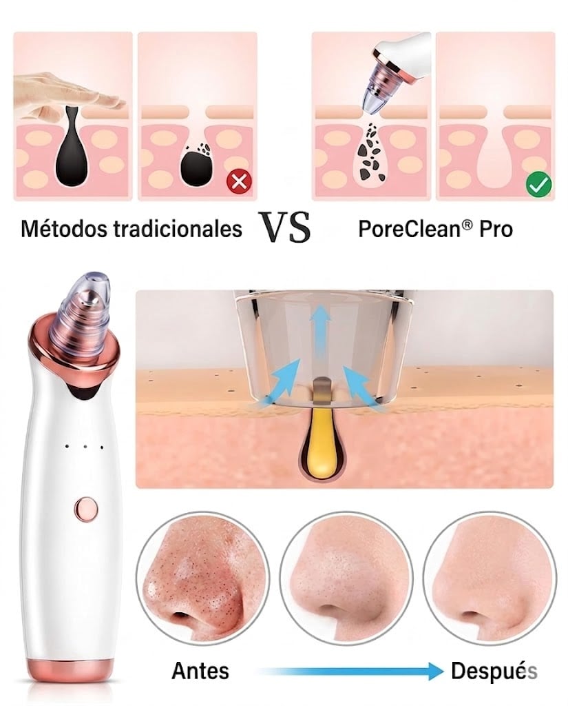 ✨ PoreClean® Pro — Adiós puntos negros y espinillas visibles en minutos