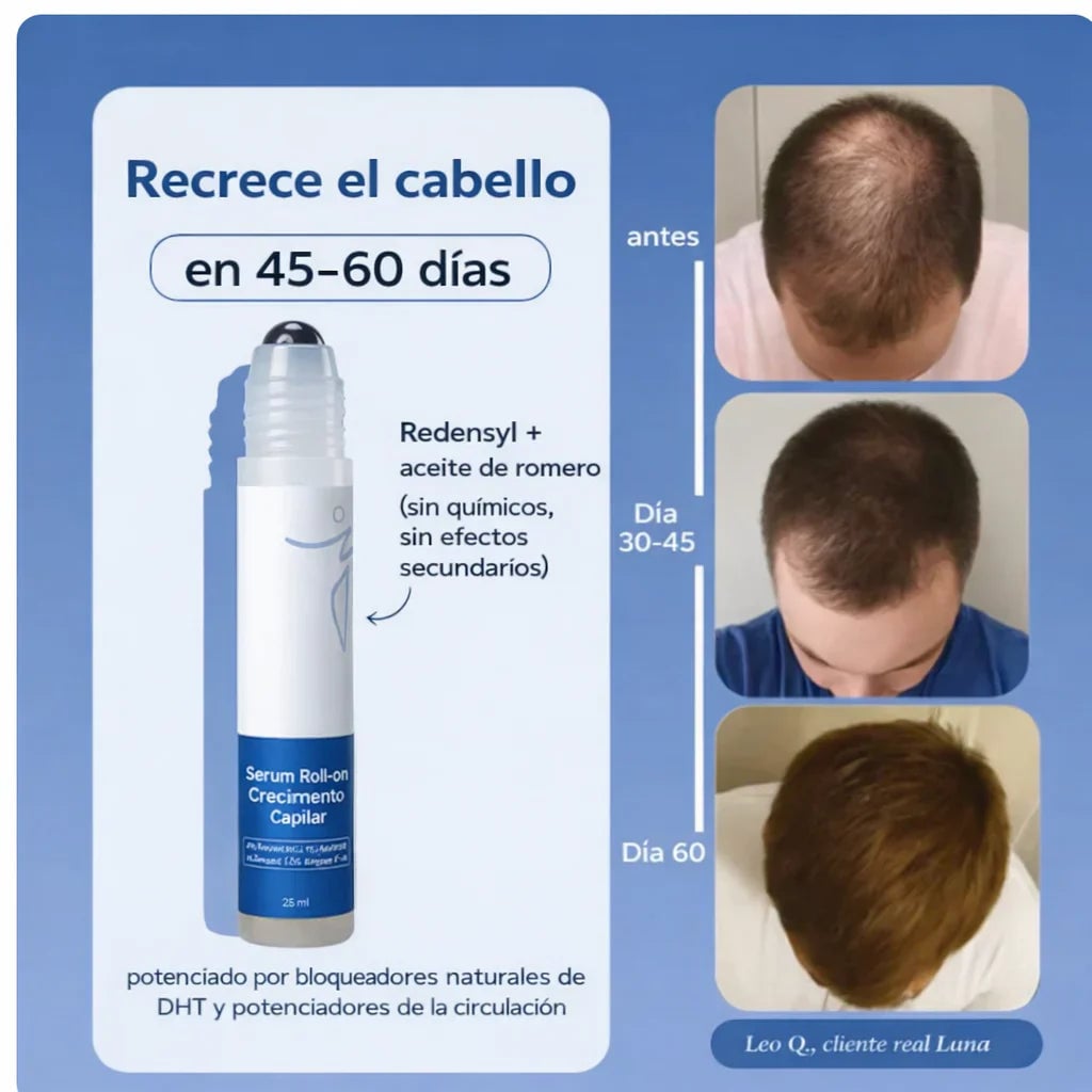 BODYWISE™: Roll On Capilar de Triple Acción que Reactiva Folículos y Fortalece el Crecimiento del Cabello