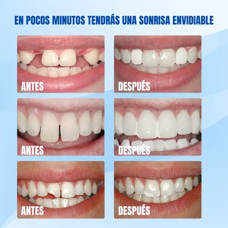 ULTIMAS UNIDADES - RESINA DENTAL MOLDEABLE 💫 ENVÍO GRATIS