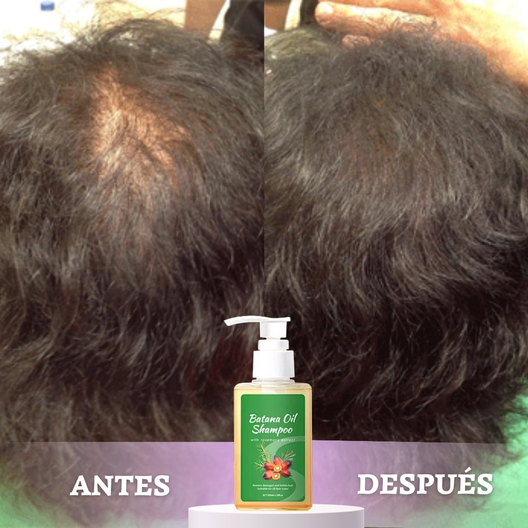 Combo Shampoo y Aceite de Batana Oil