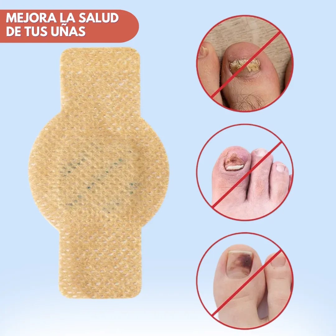 DermaPatch™ Parche Antifúngico para Hongo