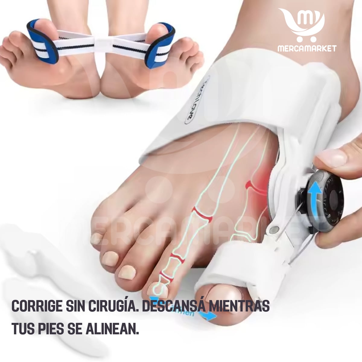 ENVIO GRATIS Corrector ortopedico para juanetes-Evita que el problema avance: corrige desde casa