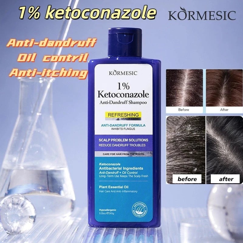 Champú Anticaspa Con Ketoconazole al 1% + ENVIO GRATIS