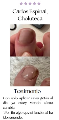 JoyPretty™ ¡Elimina los hongos de tus uñas de raíz!