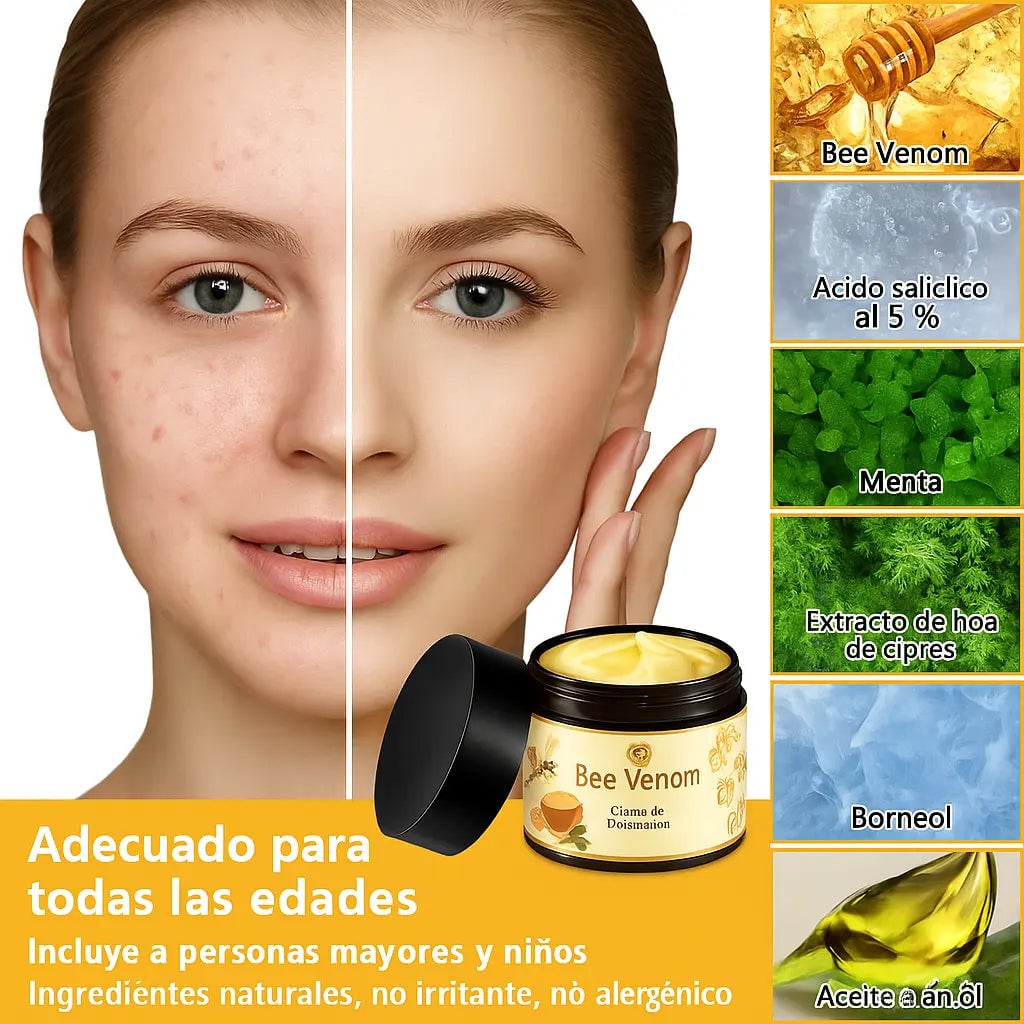 馃巵 Paga 1 - Lleva 2 馃槏 馃尶Bee Venom Cream 鉁limina una amplia gama de problemas de la piel