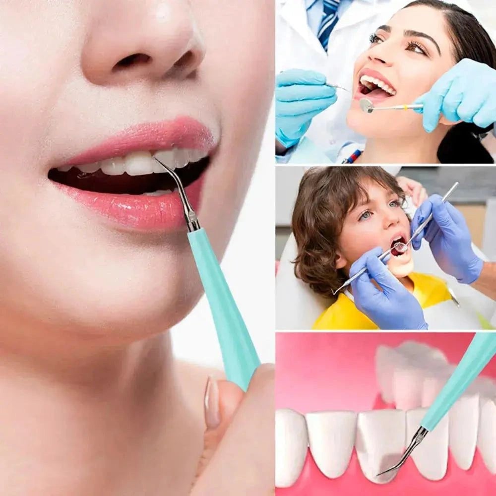 Removedor SmilePro® ORIGINAL. Limpieza Ultrasónica