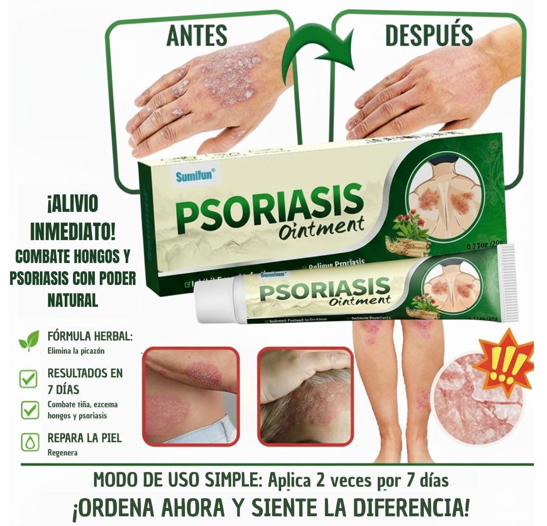 ✅ PSORIASIS™ | Alivia la picazón y el enrojecimiento de la piel desde la primera aplicación ☀️