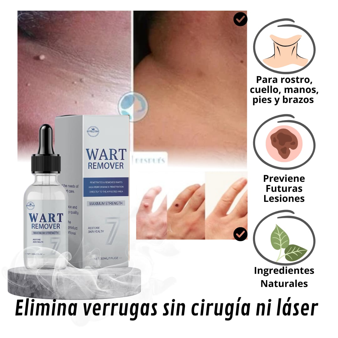 WART REMOVER | REMOVEDOR DE VERRUGAS Y LUNARES