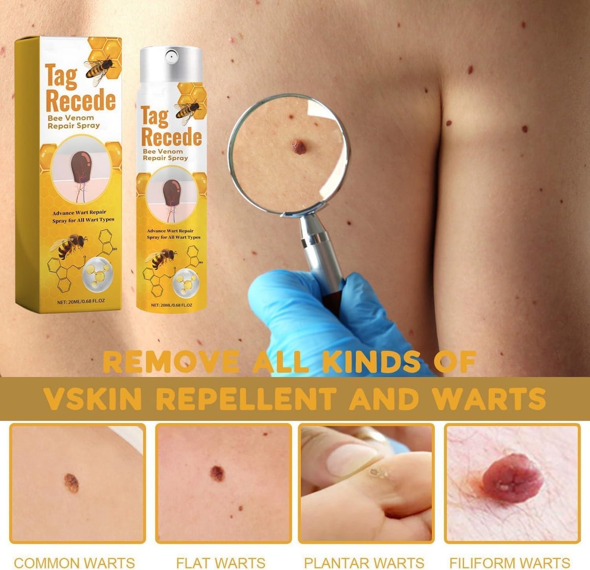 ELIMINADOR DE VERRUGAS ORIGINAL TAG RECEDE + ENVIO GRATIS