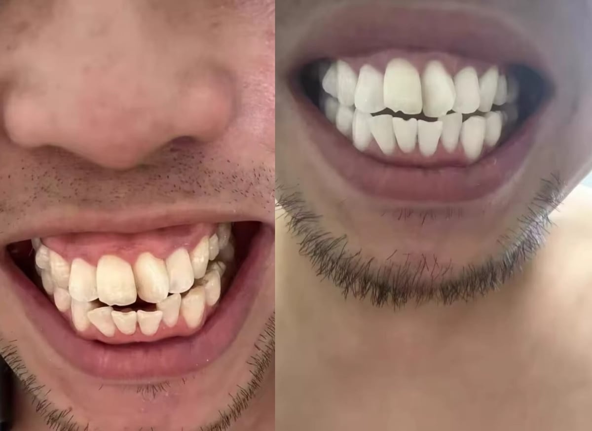 Foto de Brian Ortega