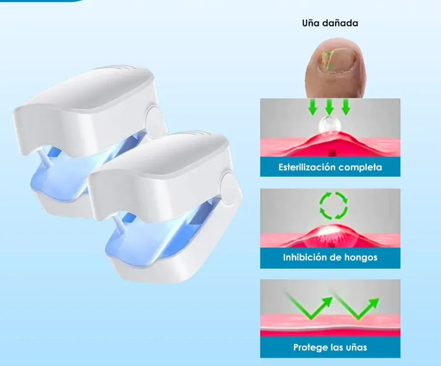 Laser Para Quitar Hongos De Las Uñas. (Onicomicosis Láser)®