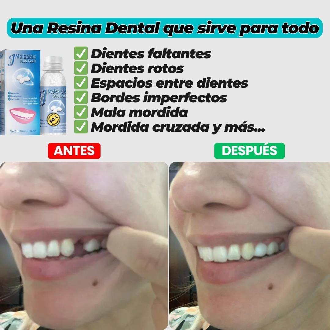ULTIMAS UNIDADES - RESINA DENTAL MOLDEABLE 💫 ENVÍO GRATIS