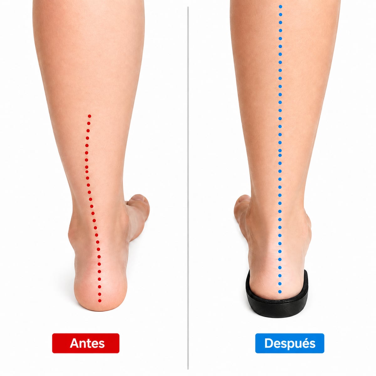 Plantillas StepGel Pro™️ - Alivia dolores de espolón y fascitis.