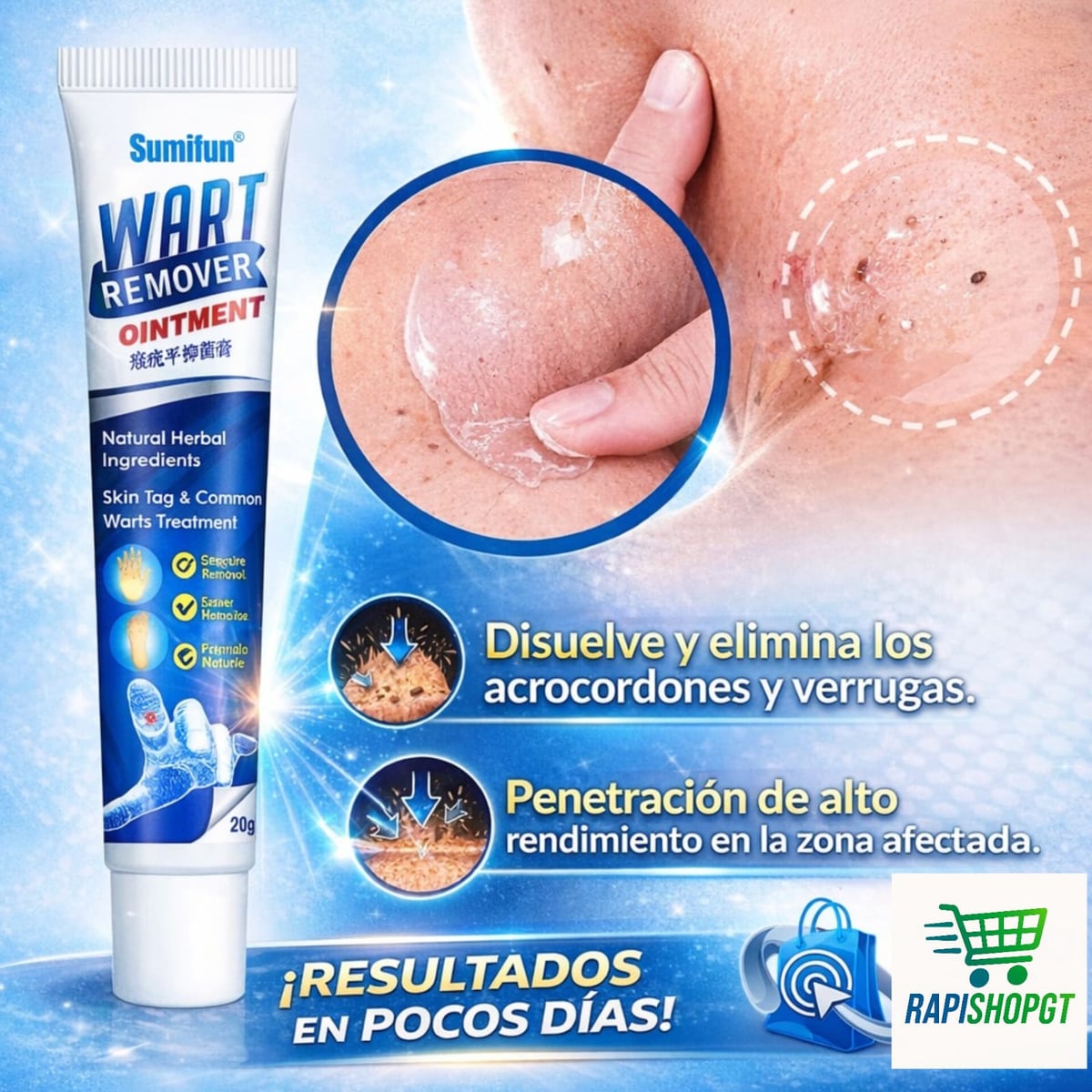 Wart Remover™ Indoloro, práctico y pensado para tu piel