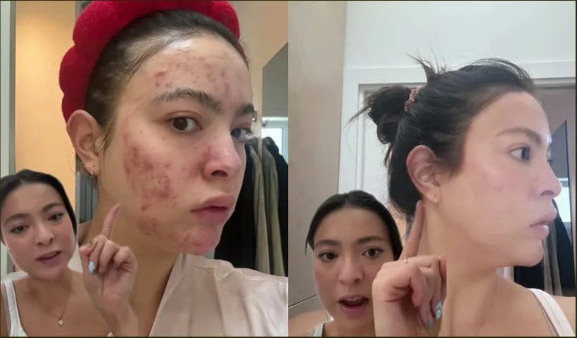 Antes y después de Sara