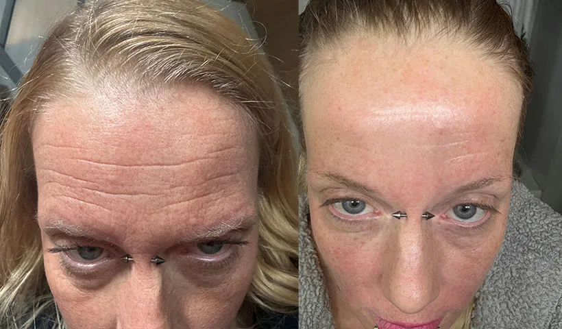 Antes y después de Sarah