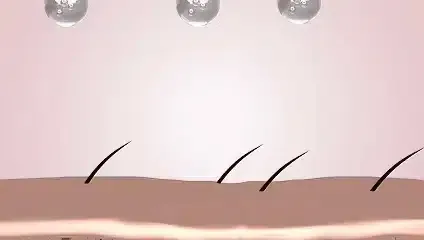 Cómo crece el cabello desde el folículo