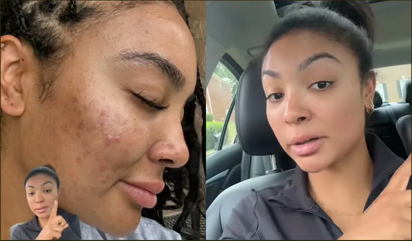 Antes y después de Ángela