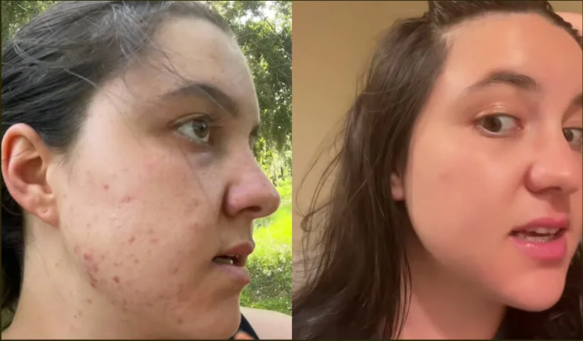Antes y después de Olivia